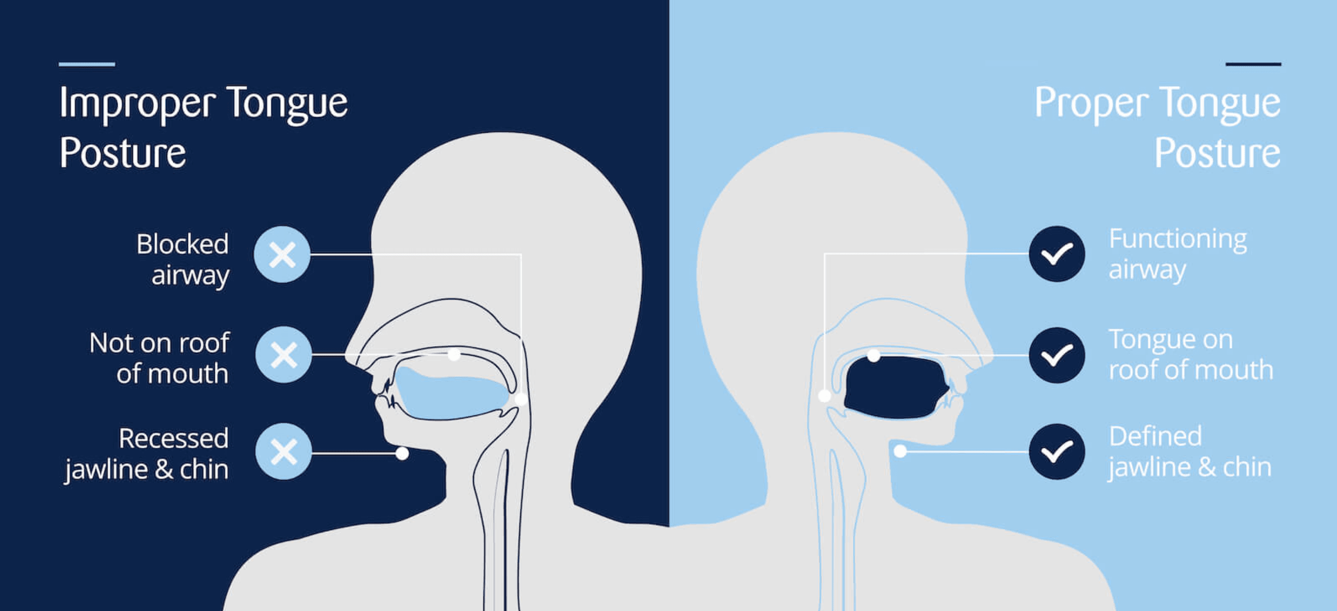 The Hidden Habit: Proper Tongue Posture