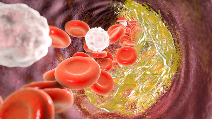 What You Should Know About “Good” and “Bad” Cholesterol