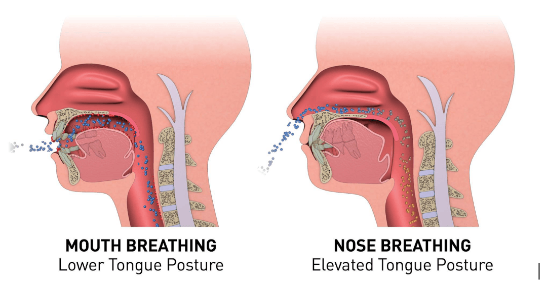 Is Mouth Breathing Secretly Wrecking Your Body?